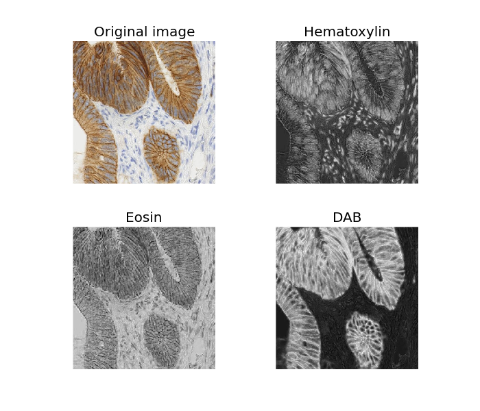 ../_images/plot_ihc_color_separation_1.png