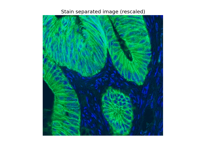 ../_images/plot_ihc_color_separation_2.png