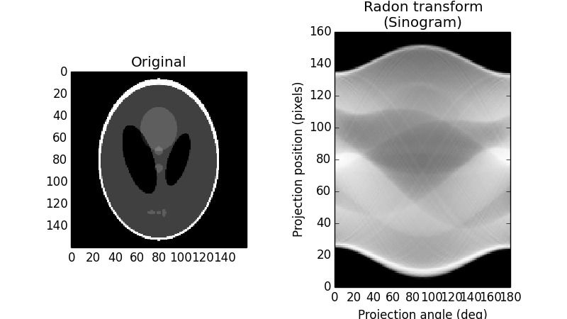 ../_images/plot_radon_transform_1.png